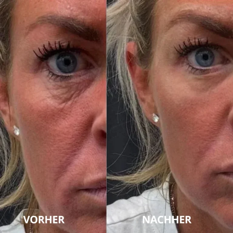 Luxevéria Die Peptid-Kollagen Hydrogel Augenpads