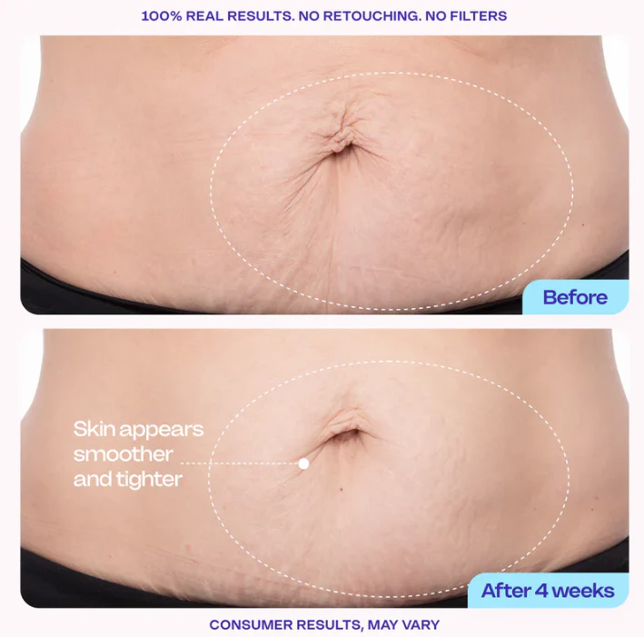 Tiworld™ Belly Bloom Abdominal Cream