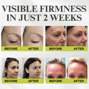 Tiworld® Botox & Vita-A Retinol Shot Wrinkle-Lift Tightening cream