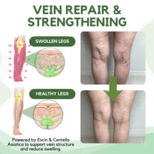 RZXEA™ Next-Gen Lymphatic Drainage & Vein Repair Cream