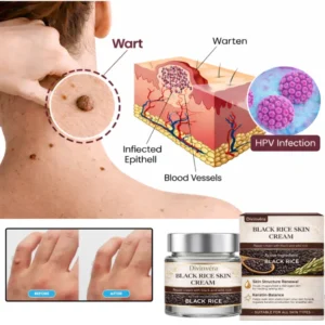 Divinvéra Black Rice Skin Cream