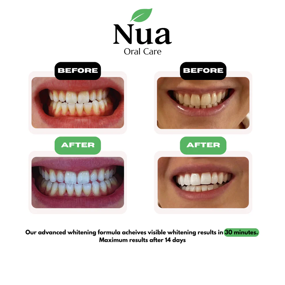 Nua Oral Care Teeth Whitening Strips