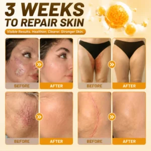 Devioa® Bee Poison Skin Restoration Cream