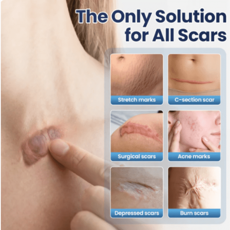 Luxevéria Scar Removal Cream