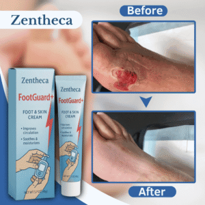 Zentheca FootGuard+ Foot & Skin Cream