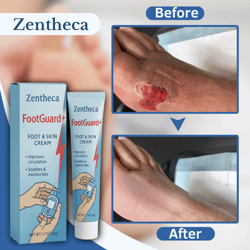 Zentheca FootGuard+ Foot & Skin Cream