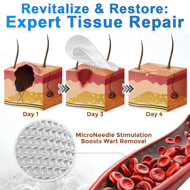 Natrvor®Patches for removing warts and moles using plant-based micro-needles