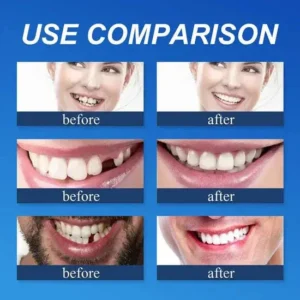 Demany Premium Full Denture Set
